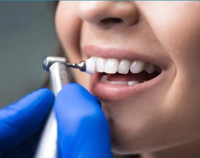 Professional dental cleaning