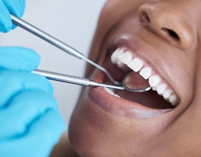 Routine dental exam